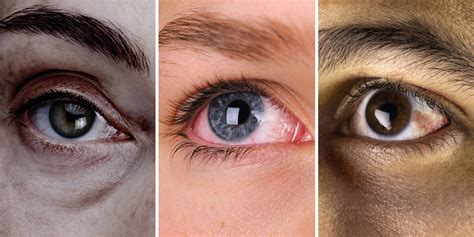 12 Things Your Eyes Are Trying to Tell You About Your Health