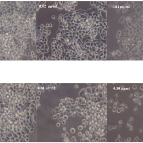 Effect Of Chromium On Hela Cells Hela Cells Were Treated With