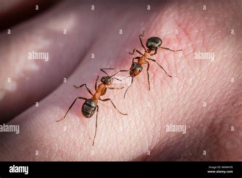 Ant Bites The Hand Stock Photo Alamy