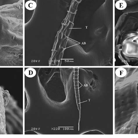 Light Photomicrographs Of The Male Of Passalurus Ambiguus Isolated From