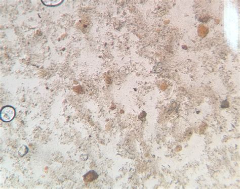 Z życia diagnosty laboratoryjnego: Owsiki