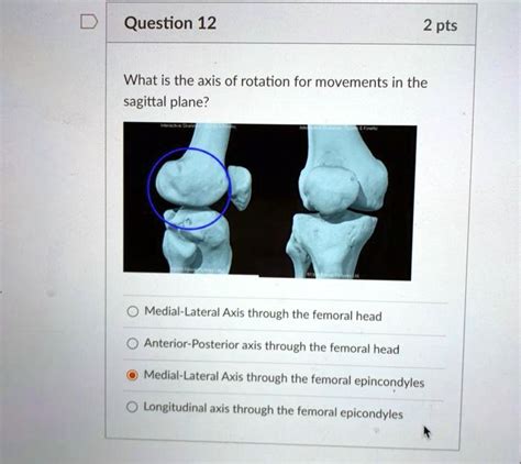 SOLVED: What is the axis of rotation for movements in the sagittal ...