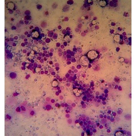 Pdf Primitive Sca 1 Positive Bone Marrow Hsc In Mouse Model Of Aplastic Anemia A Comparative