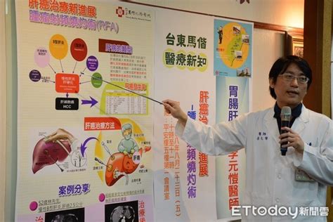 肝癌病患新福音！電燒微侵入治療 術後併發症率低成新主流 Ettoday健康雲 Ettoday新聞雲