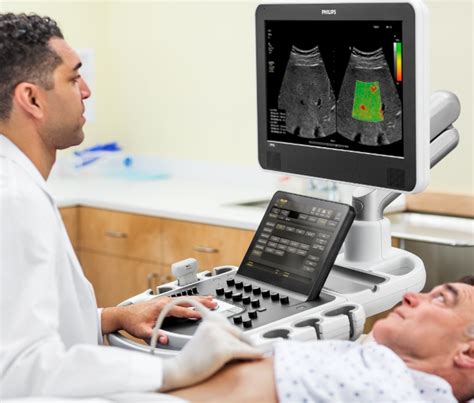 Shear Wave Elastography Precise Radiology