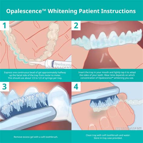 Opalescence Gel Syringes Teeth Whitening Refill Kit Packs