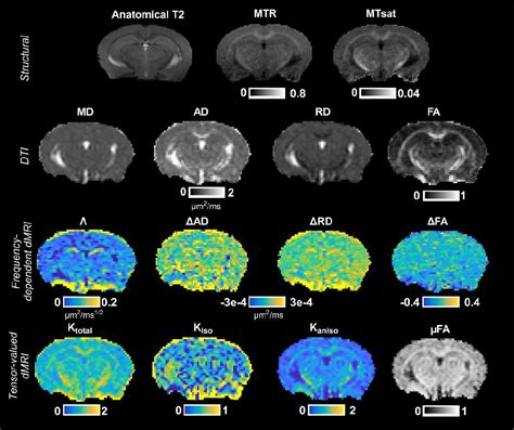 Figure 1 From Tensor Valued And Frequency Dependent Diffusion Mri And