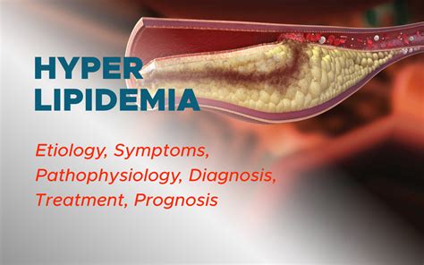 Hyperlipidemia: Etiology, Pathophysiology, Symptoms, Diagnosis ...