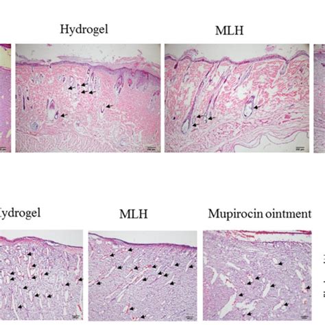 Histological Images Of Post Burn Full Thickness Wound After Treated