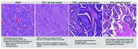 Histologic Features And Diagnostic Criteria Of Aggressive Types And