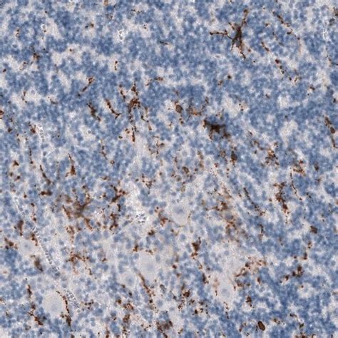 Monoclonal Anti Tmem Antibody Produced In Mouse