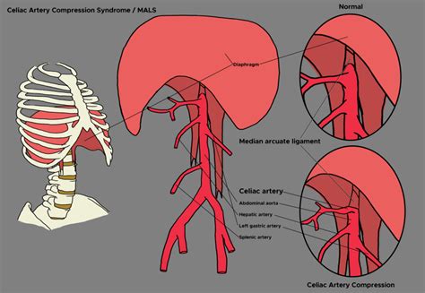 Celiac Artery Diagram