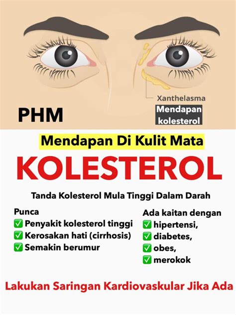 Makanan Tinggi Kolesterol Malaysia (Wajib Tahu) • Portal Kesihatan Anda