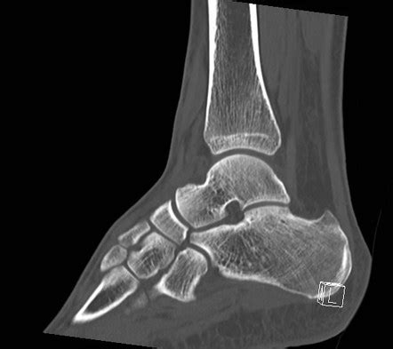 Radiology Quiz 47111 Radiopaedia Org