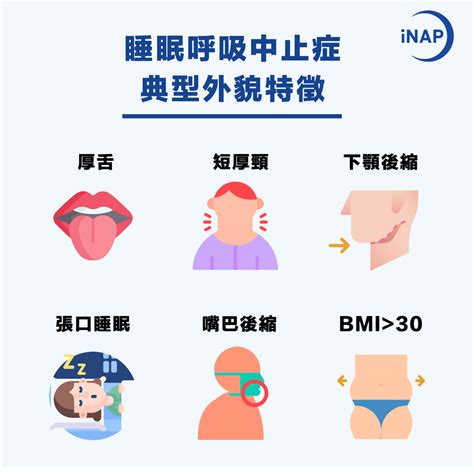 睡眠呼吸中止症 是什麼？如何診斷與治療？ Inap