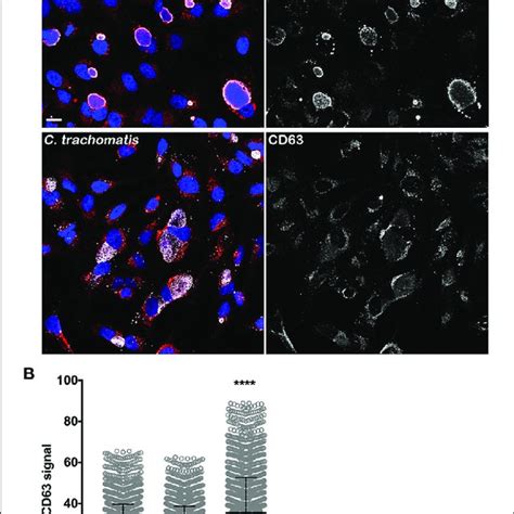 Elevated Intracellular Tf In C Burnetii Infected Cells Is Associated