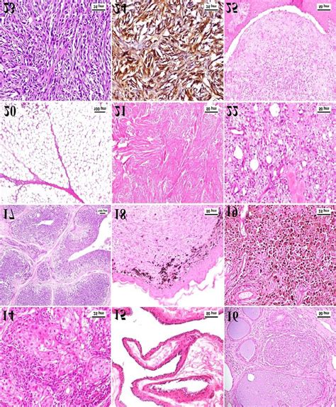 14) Canine meibomian adenocarcinoma, meibomian gland, dog. The... | Download Scientific Diagram