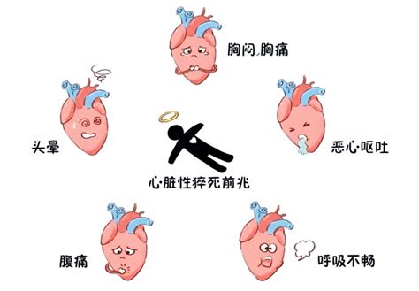 警惕心源性猝死前身体会发出这些SOS信号 知乎