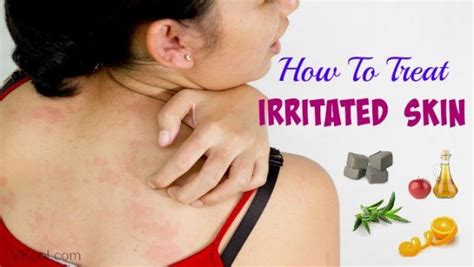 How To Treat Irritated Skin On Face And Hands 8 Tips