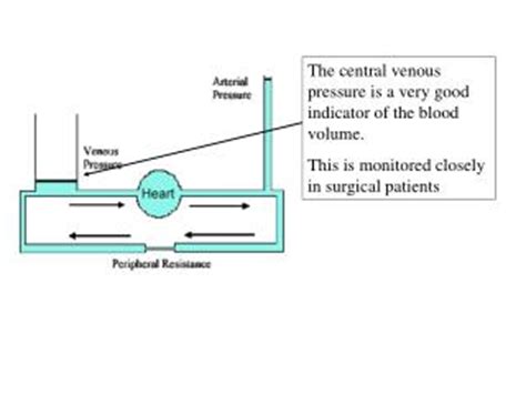 Ppt Central Venous Pressure Monitoring Powerpoint Presentation Id