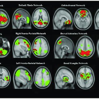 Resting State Networks Rsns Displayed Significant Intra Network