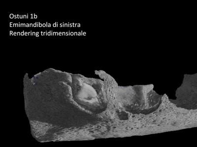 Archeologia Lo Smalto Dei Denti Per Scoprire Gli Ultimi Mesi Di Vita