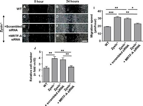 Transient Silencing Of Mrtf‐a By Sirna Diminishes The Migration And