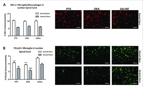 Chemotherapy Induced Changes In Microglia In The Spinal Cord Iba And