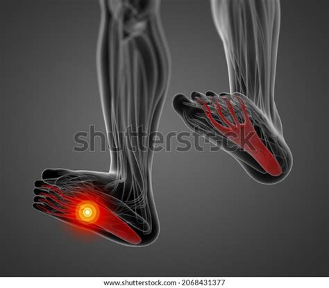 D Rendering Medical Illustration Flexor Digitorum Stock Illustration