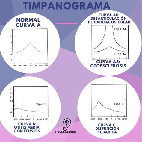 Timpanograma NeuroMedicine UDocz