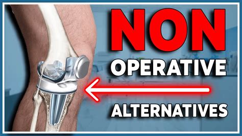 5 Non Operative Alternatives To Knee Replacement What You Need To Know