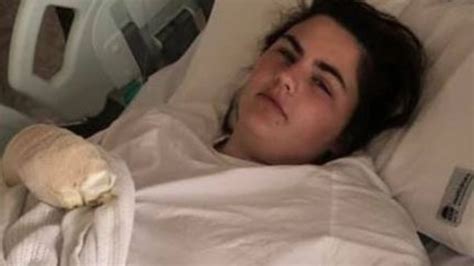 Exploding Hot Water Bottle Burns Hunter Valley Mum News Au