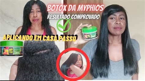 Aplicação De Botox Sozinha Em Casa Retoque De Raiz Com Mytox Da Myphios Myphios Youtube