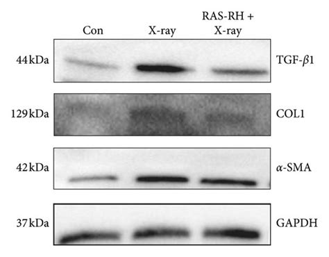 Ras Rh Alleviated The Expression Of Tgf Col And Sma In Cfs