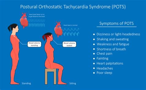 What Is Syncope And Orthostatic Hypotension Syncope And Orthostatic Hypotension Treatment