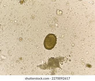 Ascaris Lumbricoides Egg Human Parasite Stool Stock Photo