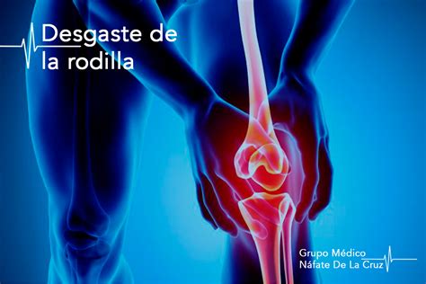 Qué es el Desgaste de Rodilla Centro Médico