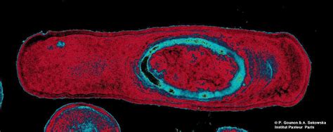 bacillus subtilis - JungleKey.fr Image