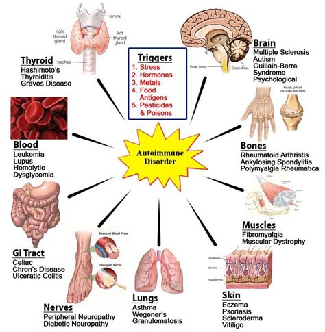 Autoimmune