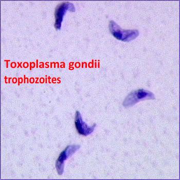 Toxoplasmosis Flashcards Quizlet