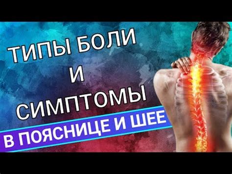 ТИПЫ БОЛИ В ПОЯСНИЦЕ И ШЕЕ И ИХ ОТЛИЧИЯ - YouTube
