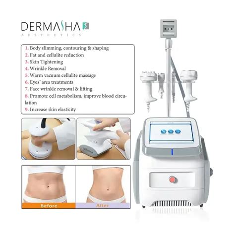 Portable In Vela Body Shape Weight Loss Vacuum Cavitation Slimming