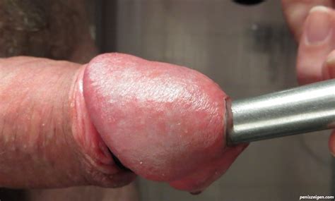 Dilator Kostenlose Penis Bilder Und Schwanzfotos