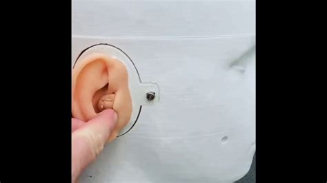 Inserting And Removing An In The Canal Itc Hearing Aid Using Carl