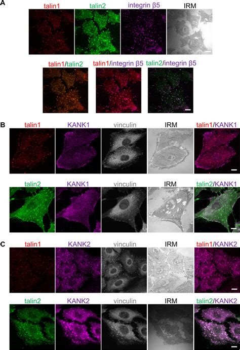 Human Melanoma Cell Line Mda Mb 435s ATCC Bioz