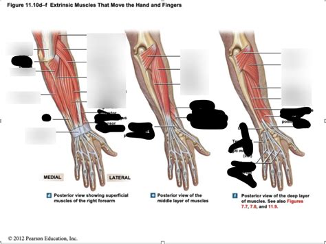 Posterior Hand Diagram Quizlet
