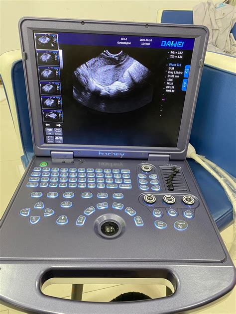 Dawei High Level B W Laptop Ultrasound Dw 360 Digital Pw Ultrasound