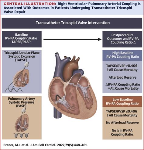 Right Ventricular Pulmonary Arterial Coupling And Afterload Reserve In