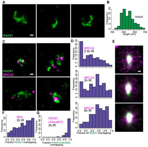 Brca And Rad Localize In Different Patterns In Ionizing Radiation