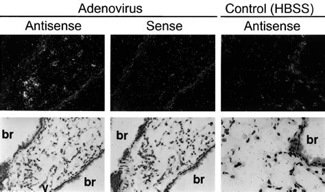 Localization Of Tnf Mrna Expression By In Situ Hybridization In Lung